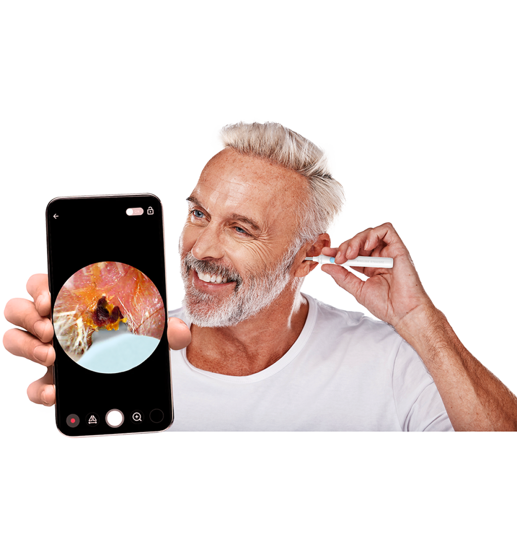 Camera Wax Remover with HD Ear Camera – Smartphone Connected Ear Cleaning Tool
