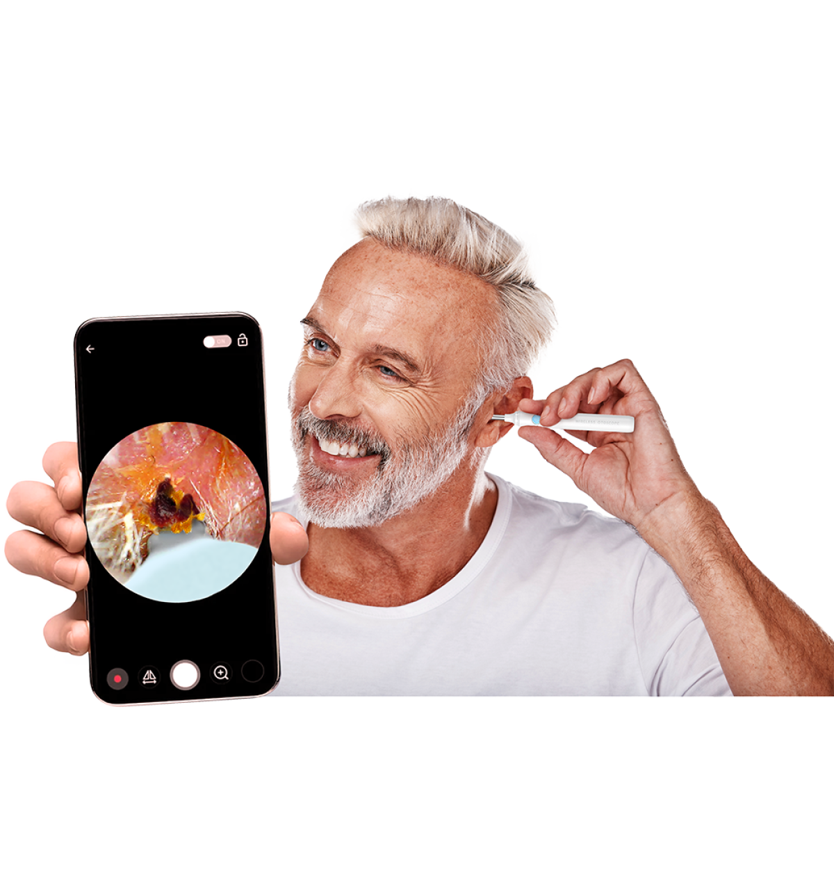 Camera Wax Remover with HD Ear Camera – Smartphone Connected Ear Cleaning Tool