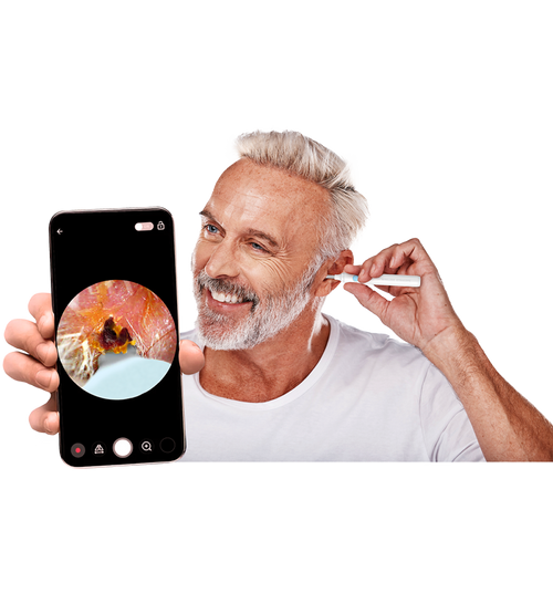 Camera Wax Remover with HD Ear Camera – Smartphone Connected Ear Cleaning Tool